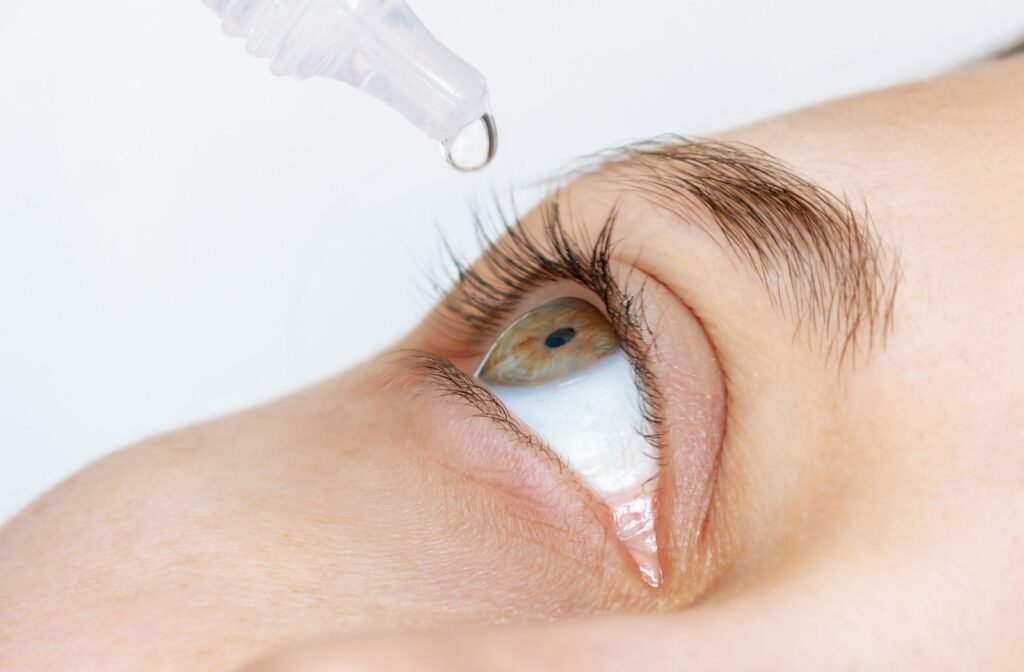 A close-up of a person administering eye drops to treat their dry eye syndrome.